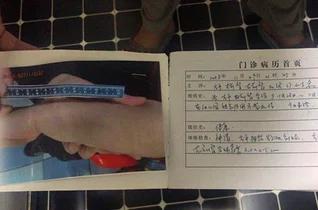 嚣张幼师虐待幼童 获刑还被终身禁业 涉事幼儿园直接凉凉
 
辽宁盘锦一幼师张某胆