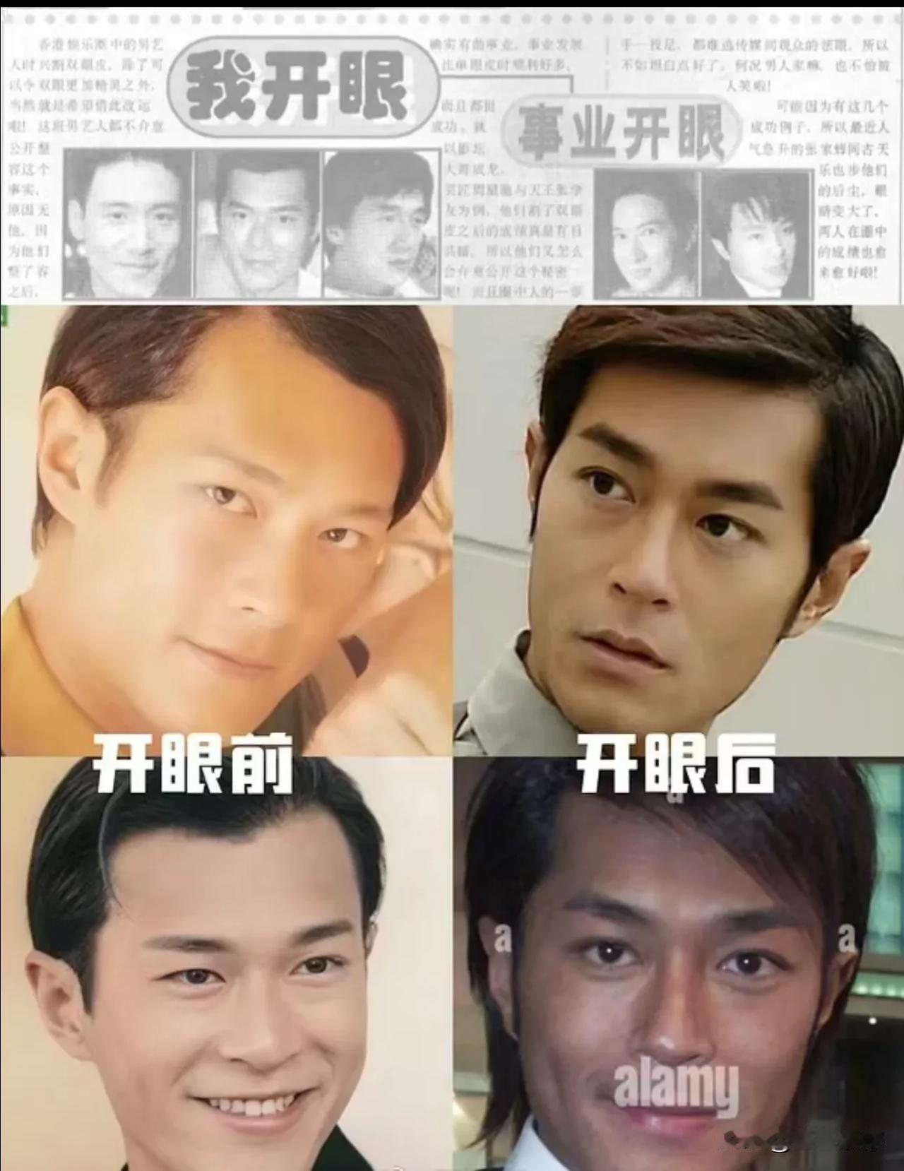 古天乐的颜值开始下坡好像就是从动眼睛开始的，眼睛的变化从04年开始就比较明显了，