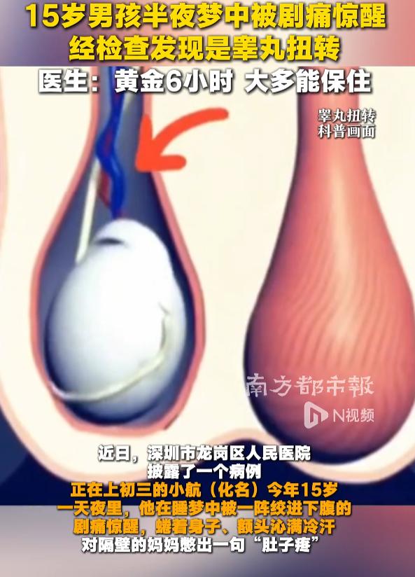 “太险了！”10月20日报道，广东深圳，一15岁男孩在睡梦中，被下腹剧痛惊醒，妈