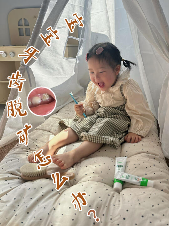 脱矿是蛀牙前兆？宝宝牙齿🦷脱矿看过来