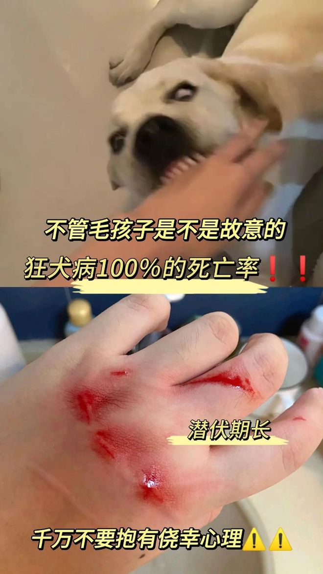 女孩怕责备隐瞒被狗咬后狂犬病去世 被狗咬了千万别去赌概率 该打针打针 狂犬病这玩