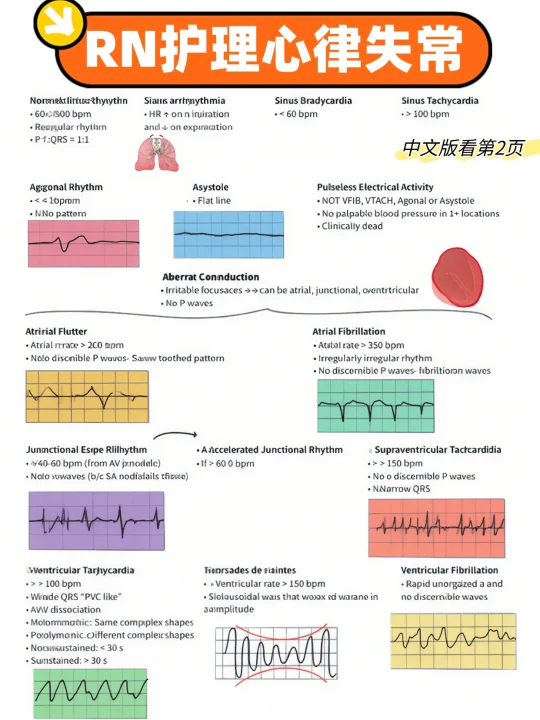 备考RN/护理心律失常！！学！！内容
