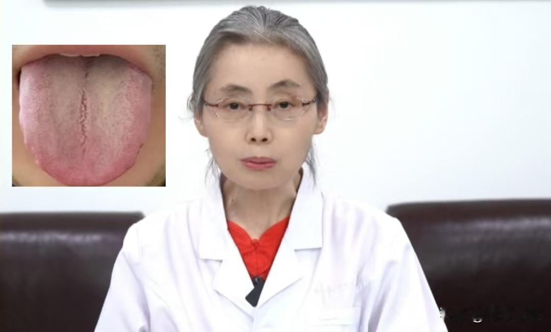 这种舌象不要上来就健脾，方向搞错，吃什么也是白搭！

患者主诉：阴囊潮湿、瘙痒，