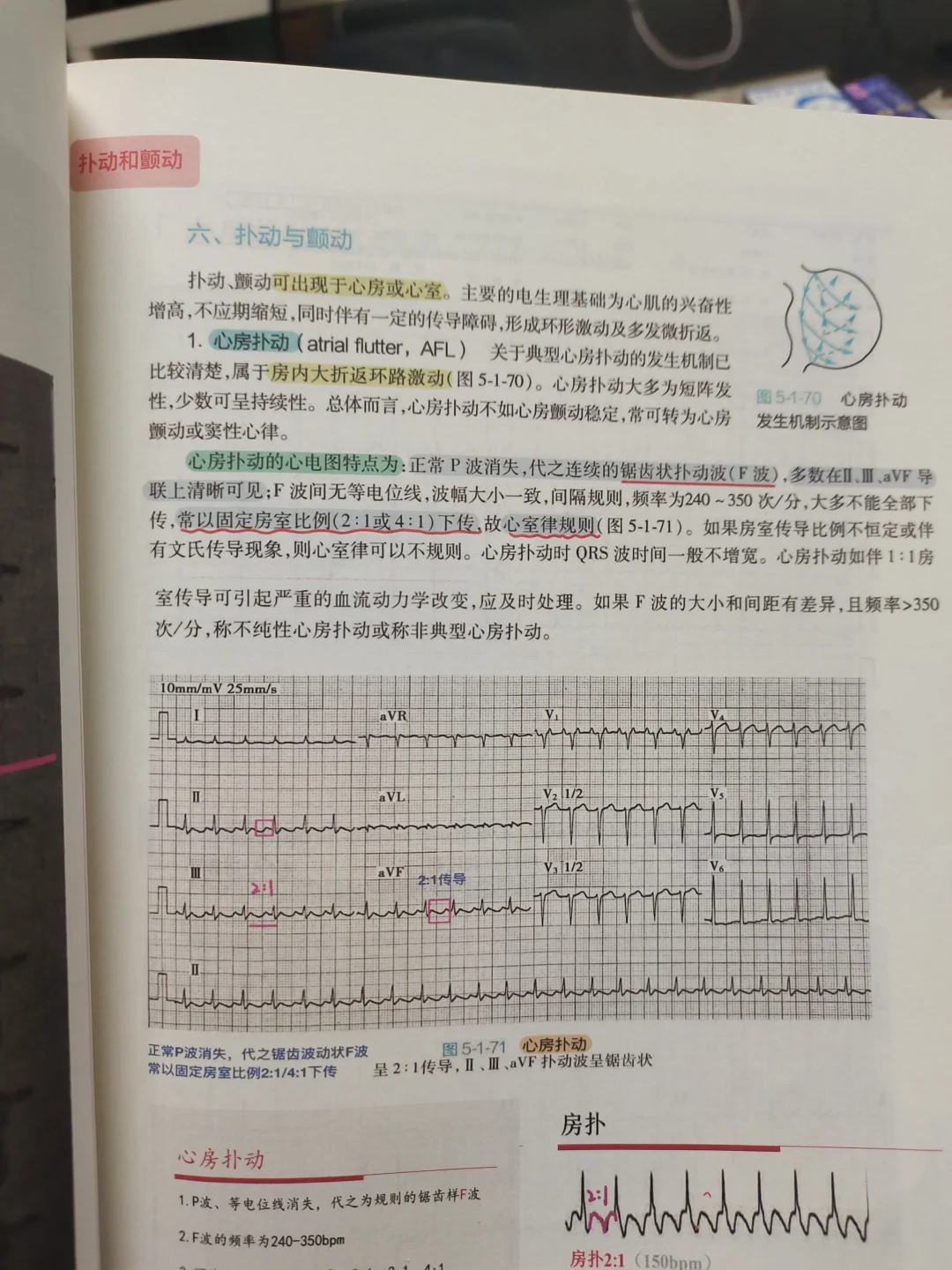心电图诊断实战笔记
