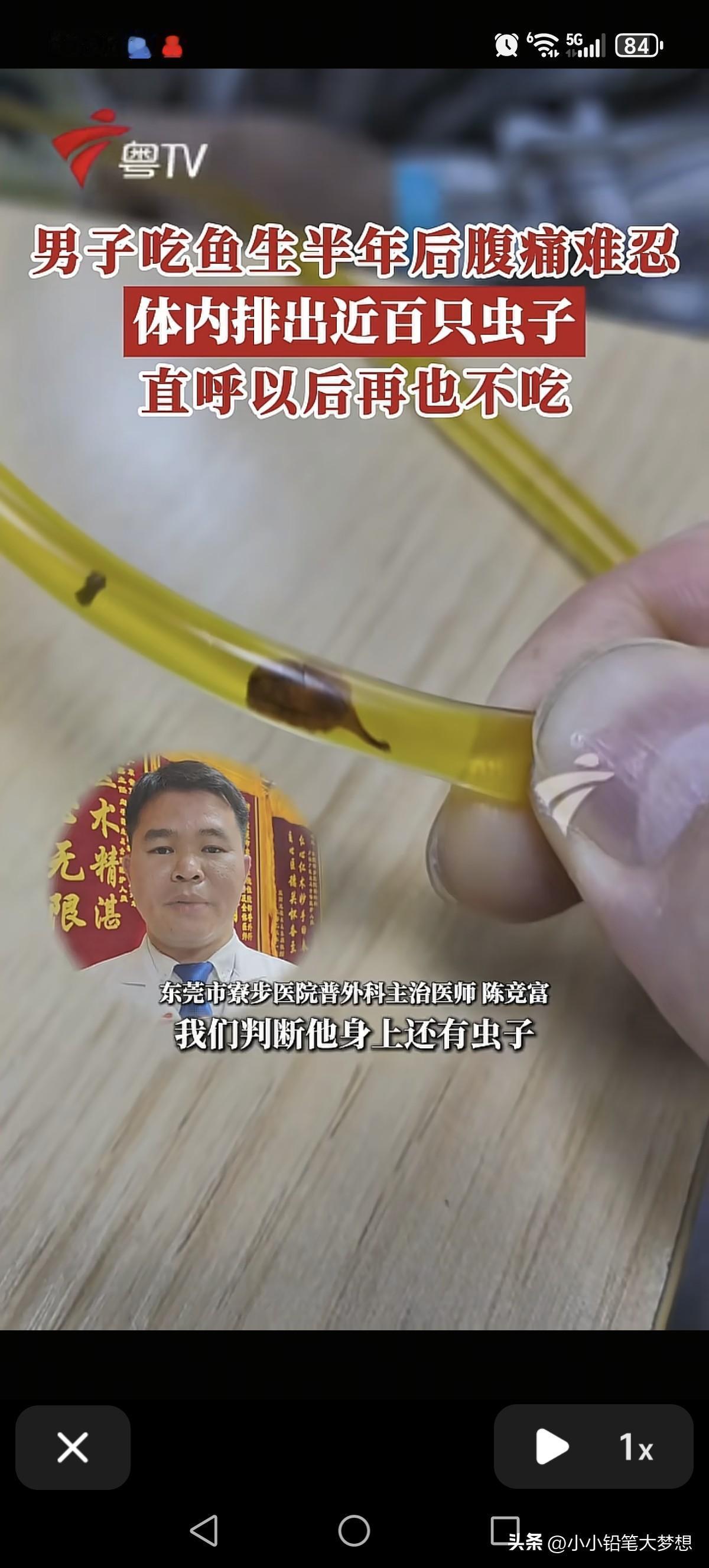 管子爬满了虫子！这个真的有点吓人呢，男子感觉自己不舒服就上医院确诊了胆囊炎和胆总