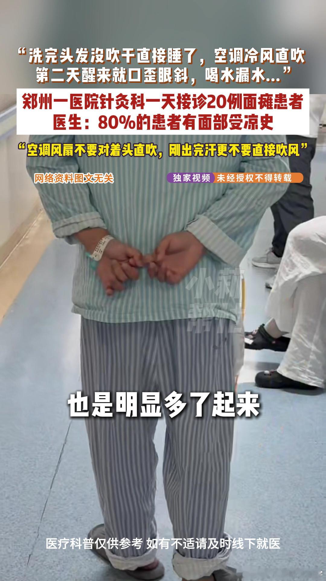 针灸科一天接诊20名面瘫患者夏季湿发直面空调易诱发面瘫 一天接诊20个面瘫患者，