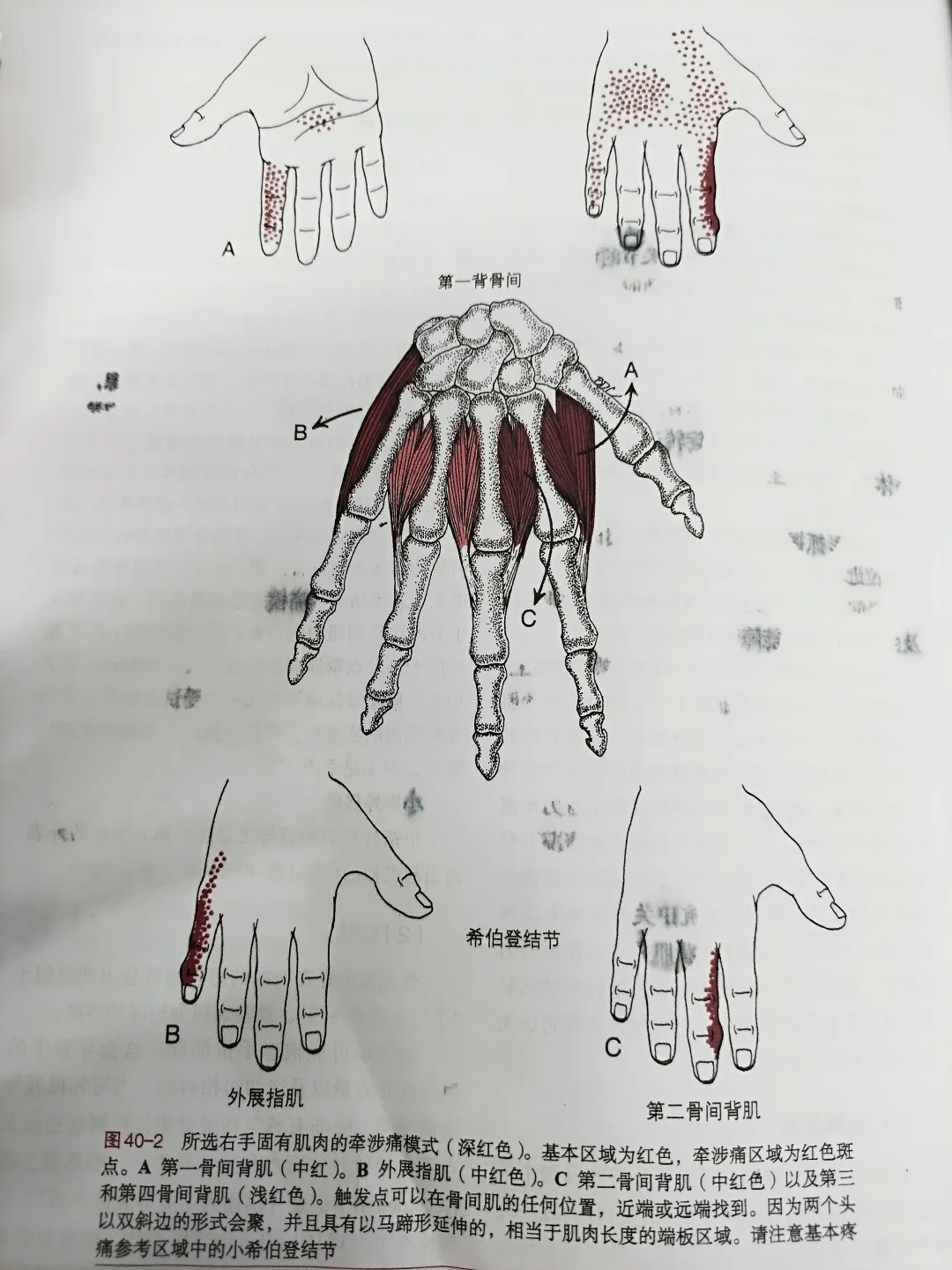 骨间肌、蚓状肌和小指展肌表现