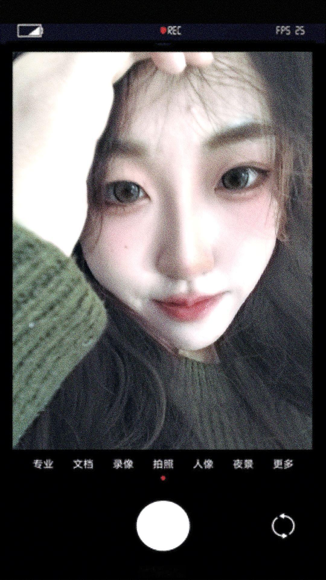长痘小孩[怒] 