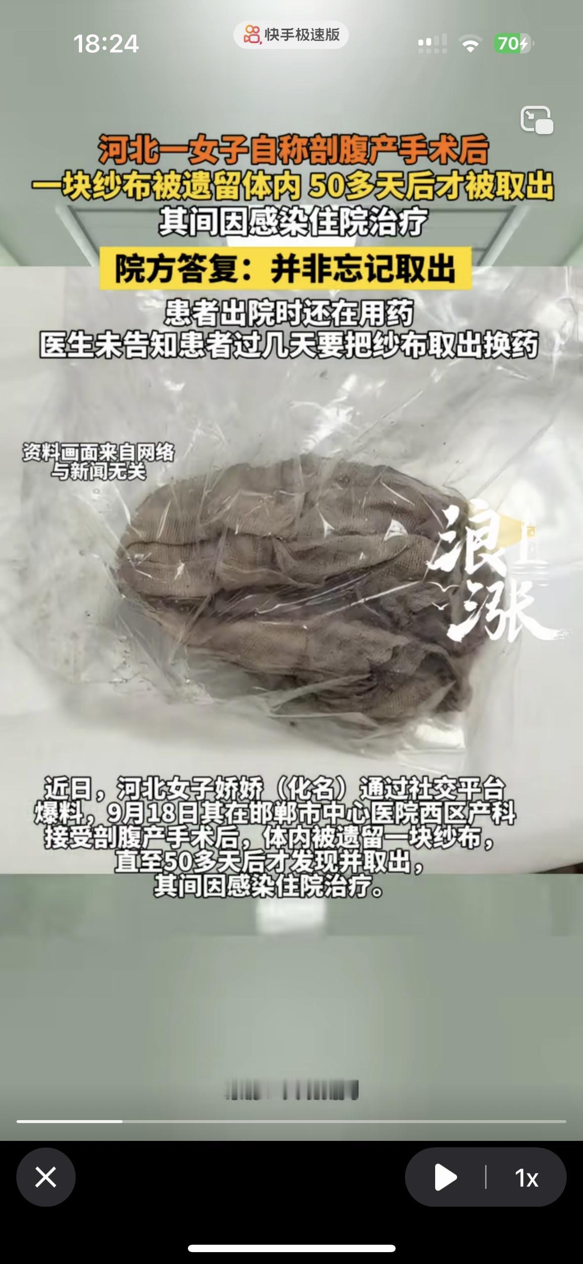 医生也太心大了！一块纱布留在患者肚子里50天
还说不是忘记取出了，难道是故意放的