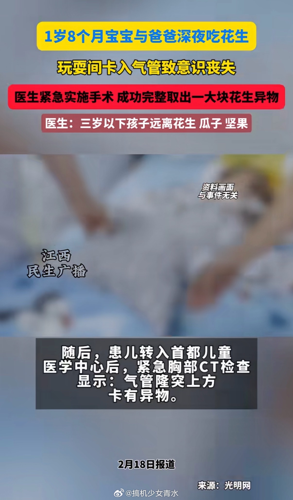 1岁9个月宝宝吃花生呛到脑部受损不能随便给吃呀过年的时候，我姐姐最担心的就是家里