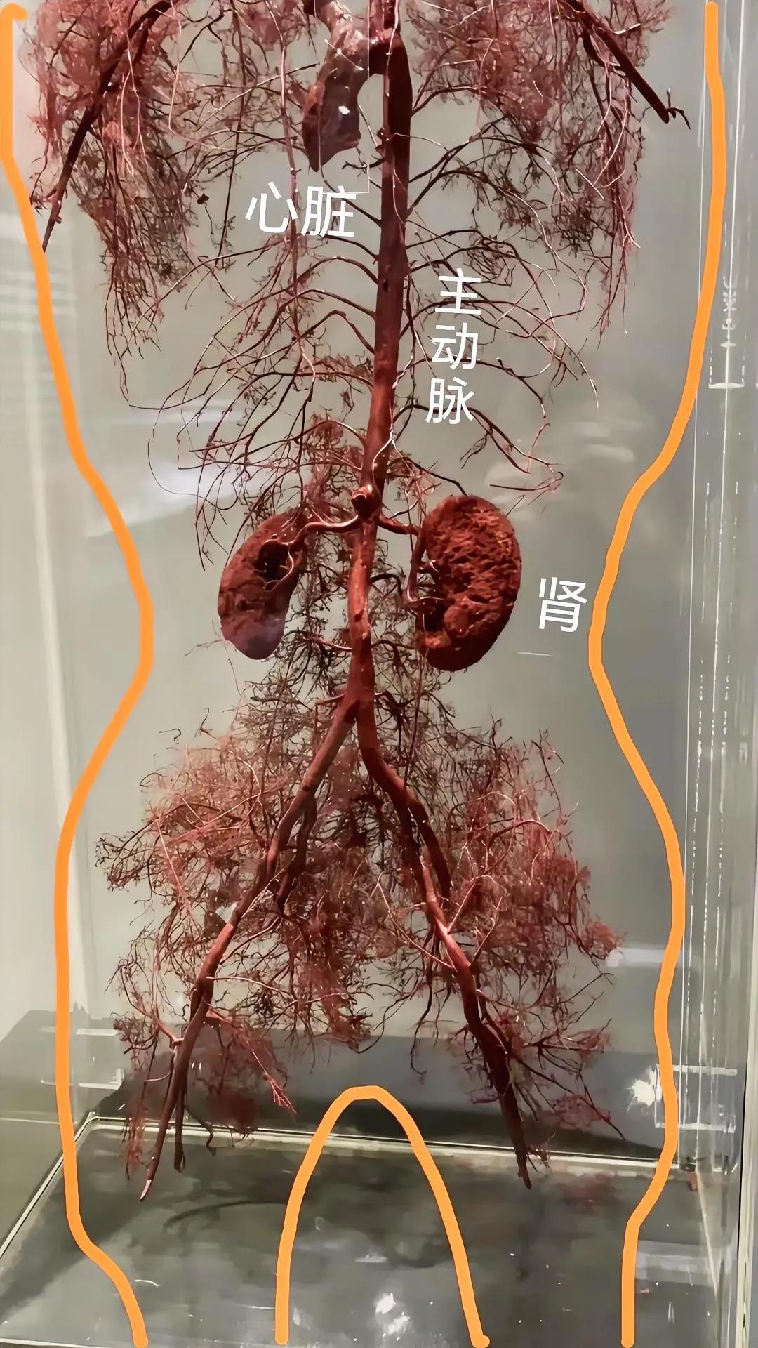 血管！[白眼]
别光看图，还要看字！

这是大体老师经过特殊工艺，去除了肌肉骨骼