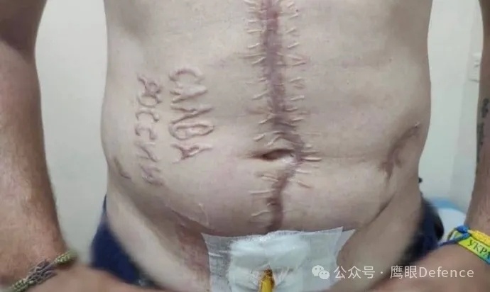 烽火问鼎计划 今天，我不再谈论那些换俘中的感人瞬间，因为我看到了更令人发指的事：