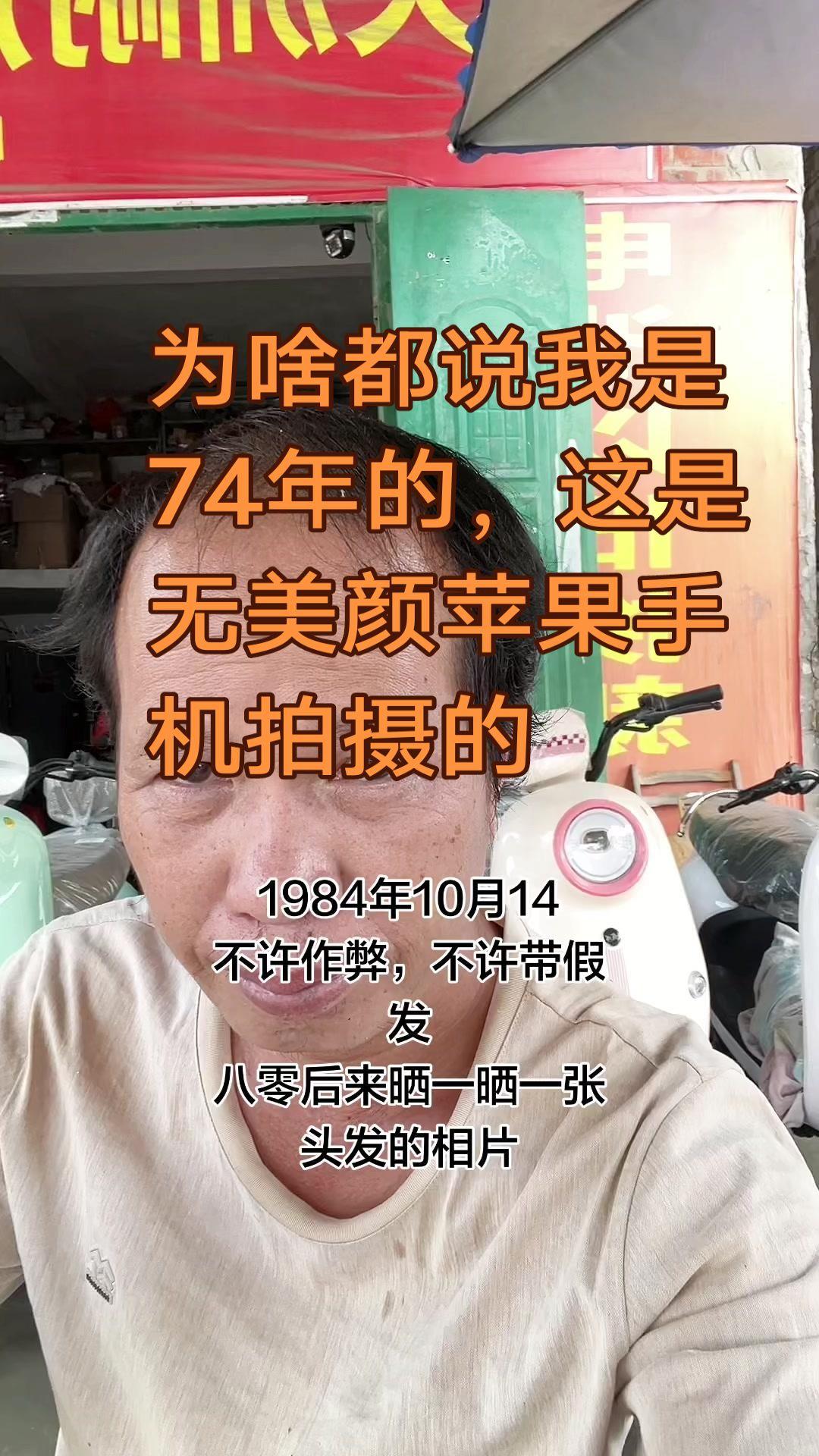 八零后头发危机，你敢直面吗？最近去阳江一趟，头发掉得更厉害，十几天就快秃了！本来