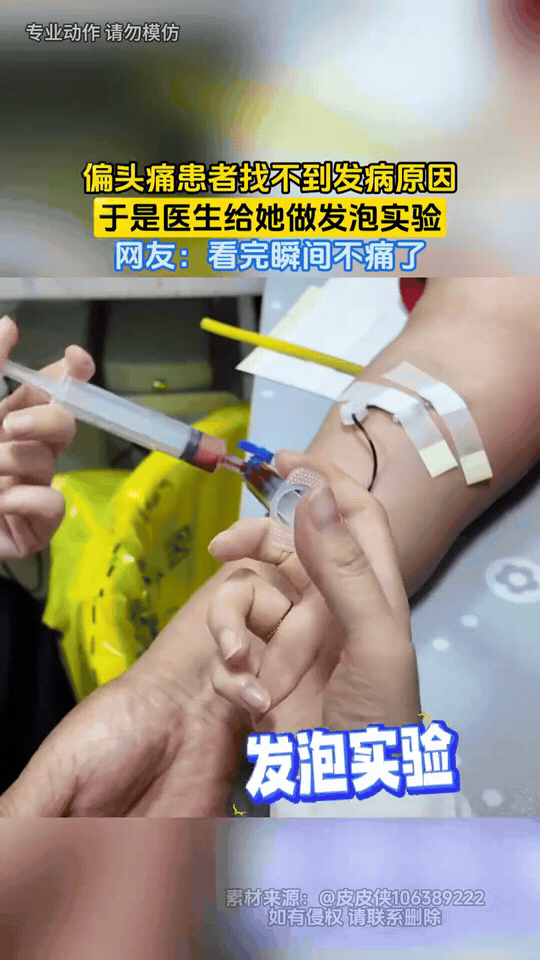 很多常年被偏头痛折磨的人，四处检查都查不出病根，这种情况，大概率要做经颅多普勒发