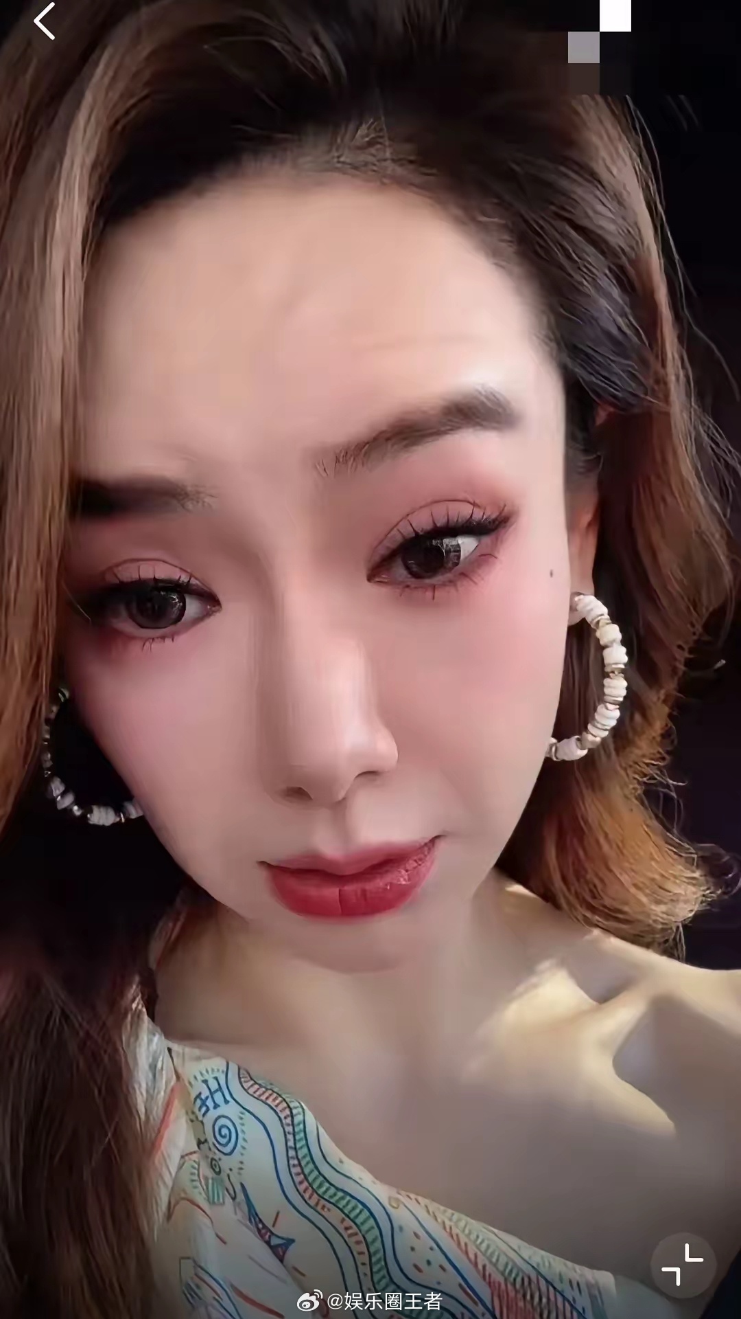戚薇大方承认医美过度戚薇的经历，所有女孩提了个醒，这脸啊不能随便do。​今天戚薇