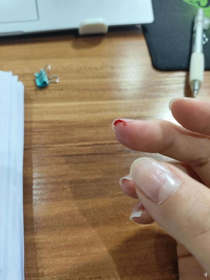A4纸伤人事件引关注，看似平常之物竟成“凶器”，细节令人揪心，后续情况待进一步明
