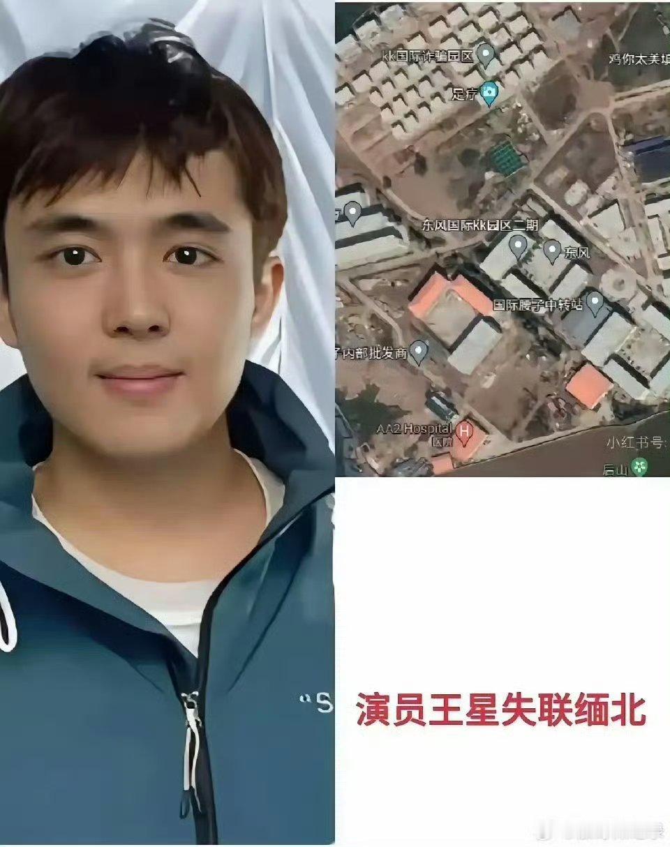 星星疑被剃去头发腿上有红斑 感觉是为了控制他给他注射什么东西了[吃惊] 
