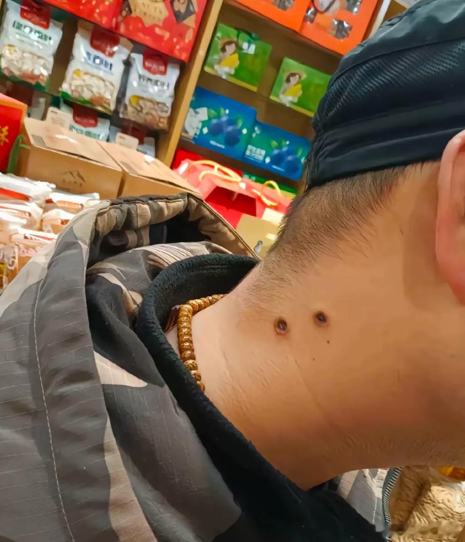 昨天晚上在山里露营迷迷糊糊不知道被什么咬了一下 今天起来感觉很难受!快死了一样!