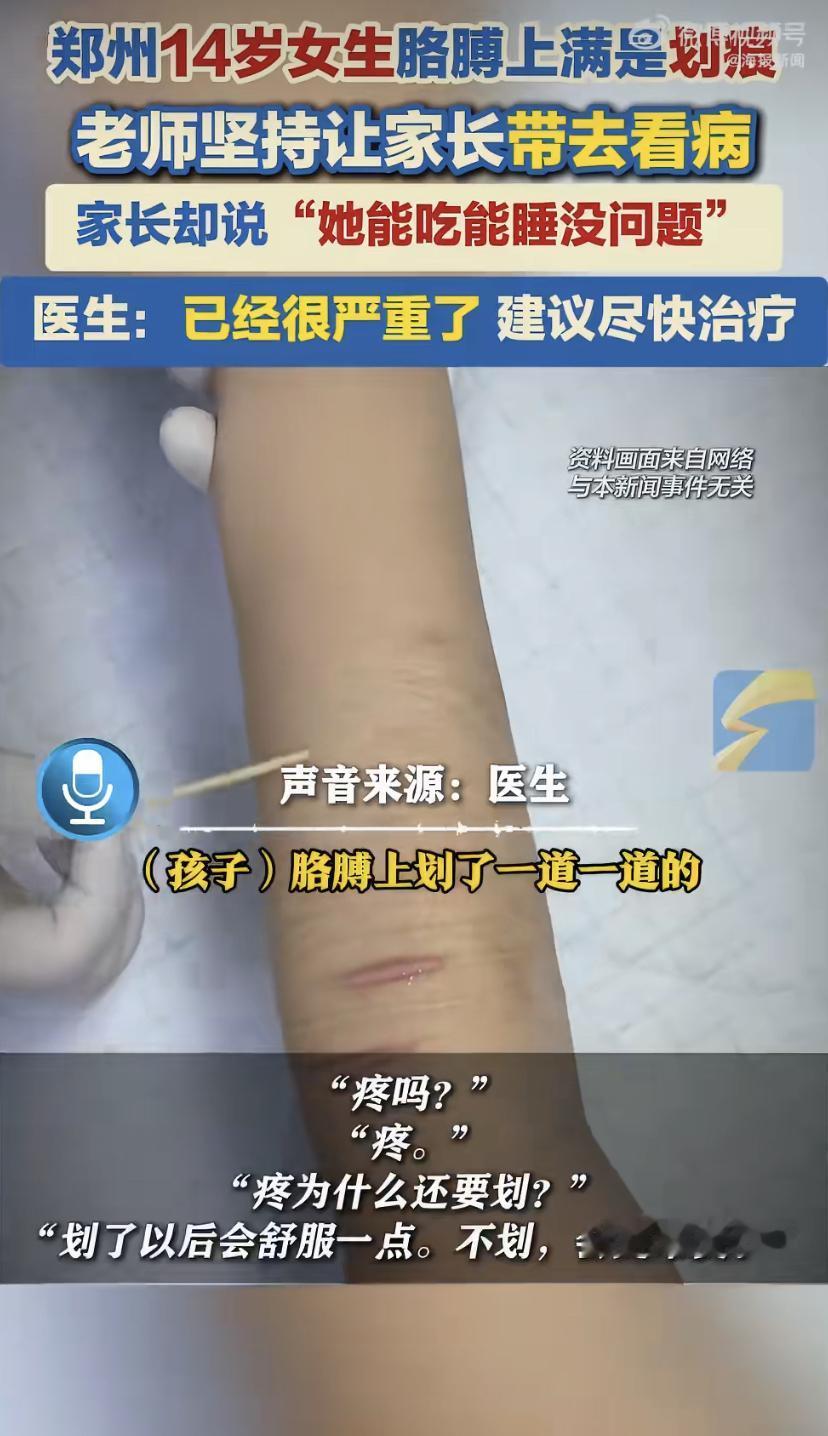 14岁女孩胳膊上全是划痕，妈妈却说：她能吃能睡，能有啥病?
郑州一个14岁姑娘晓