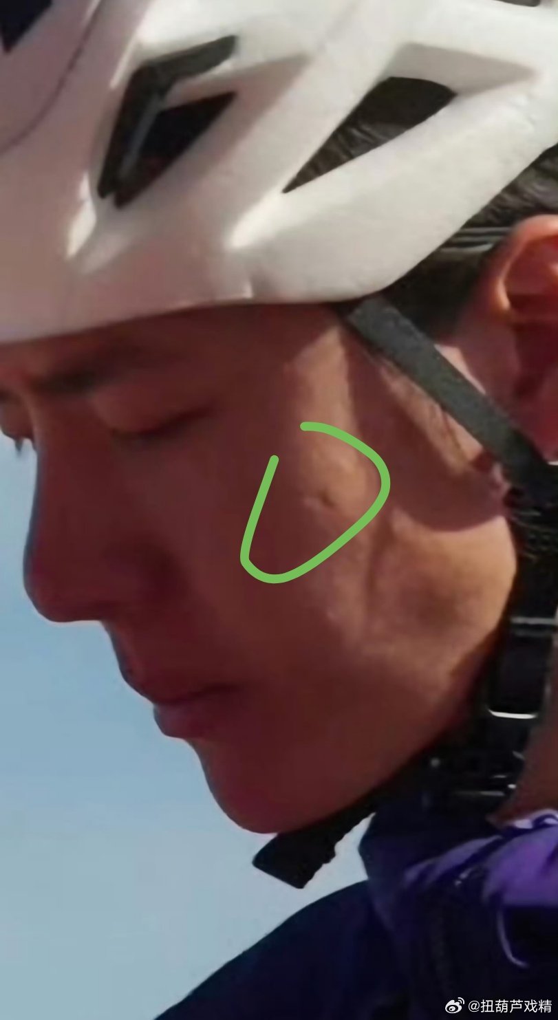 哎呀，脸上咋了？ 