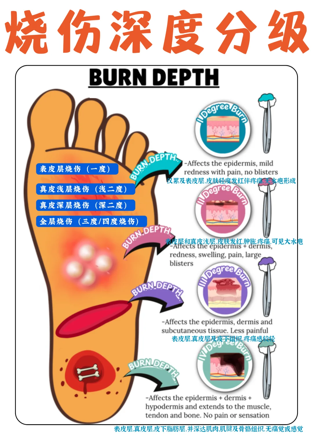 备考RN/烧伤深度分级！！学！！内容