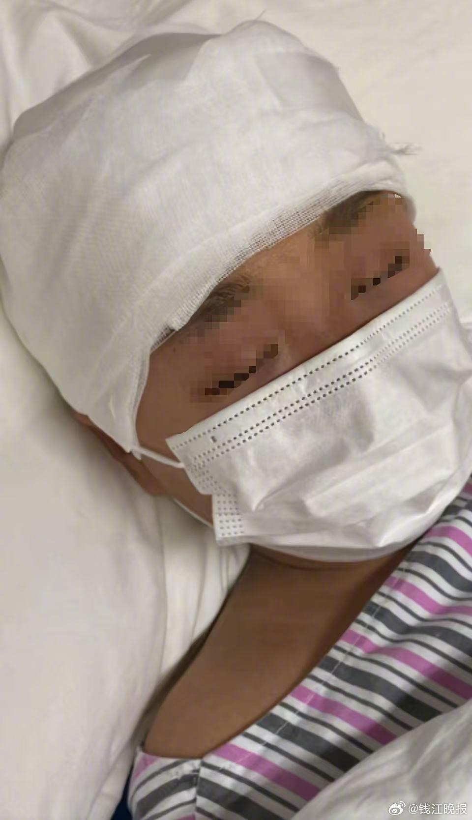 #被老师打碎头骨女孩母亲称遭死亡威胁#【#长沙被老师打碎头骨女孩母亲发声#：一家
