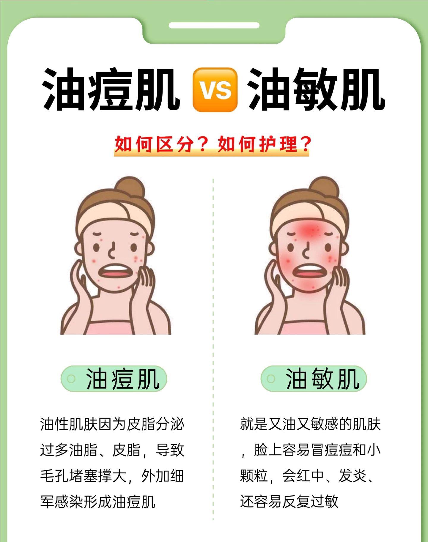 你是油痘肌还是油敏肌?赶紧来对号入座。油敏肌如何拯救痘痘肌