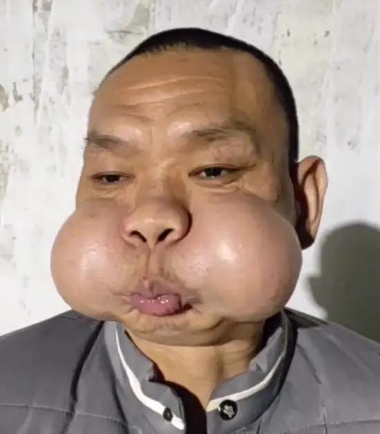 广东大叔走红，自称练成“蛤蟆功”！
一大叔最近在网上火了，但他这“火”法，真让人