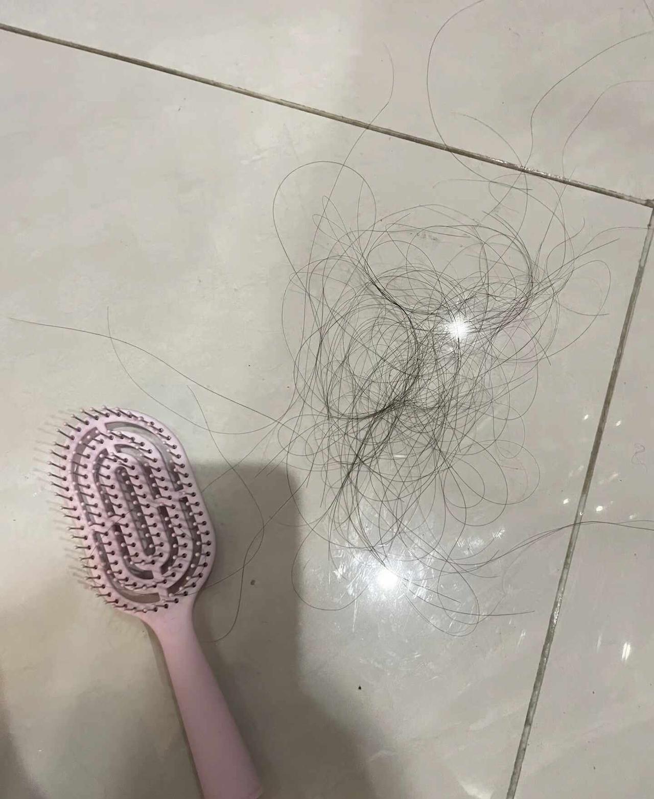 这可怎么办，感觉马上头发就没了…
有时候真的很无助