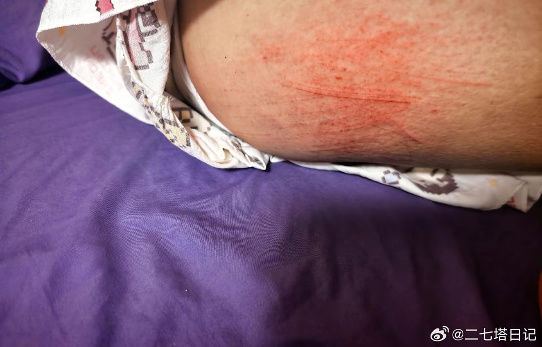 网友被台风白海豚吹走，这是真的被风刮走了 