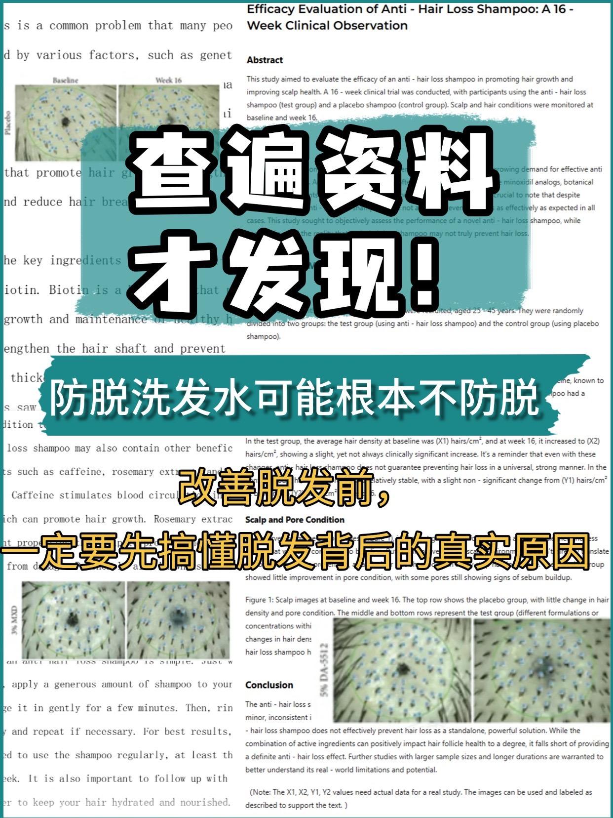 查遍资料才发现，防脱洗发水根本不防脱❕ 如果你每次洗头时手指间缠绕的发...