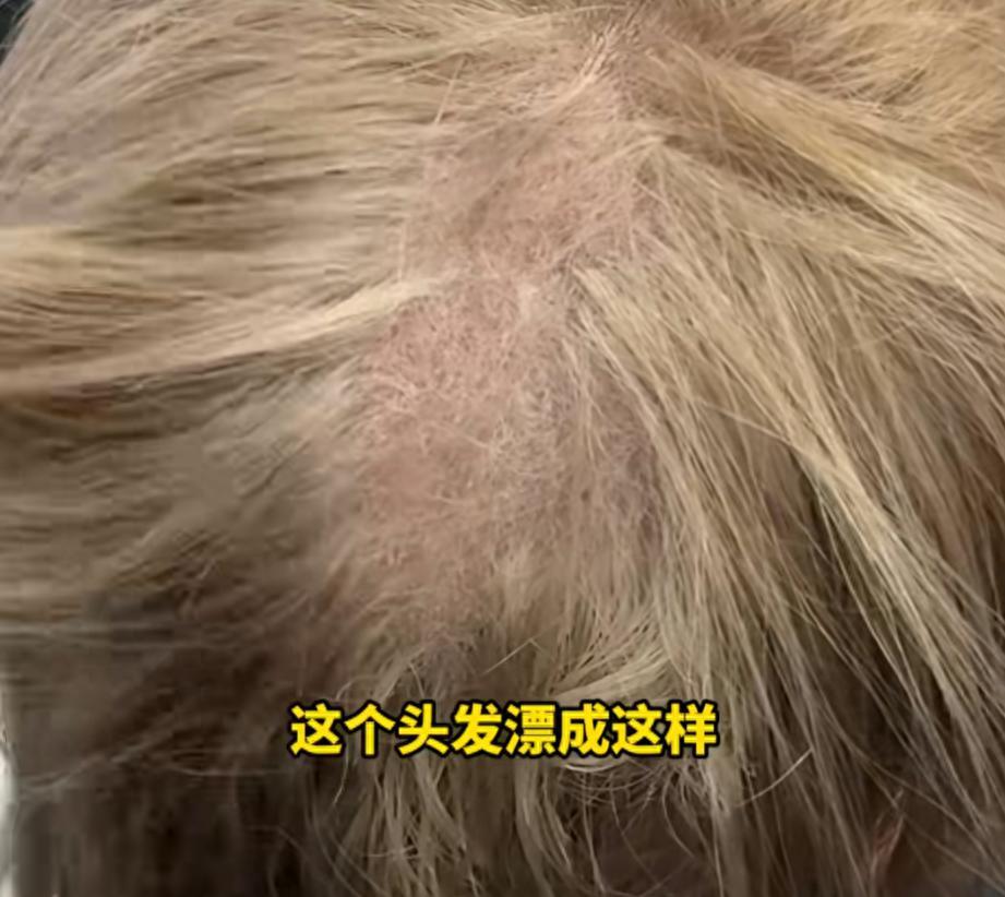 “太吓人了！”上海一女子去理发店染发，谁知，当理发师掀开她的头发时，却发现里面头