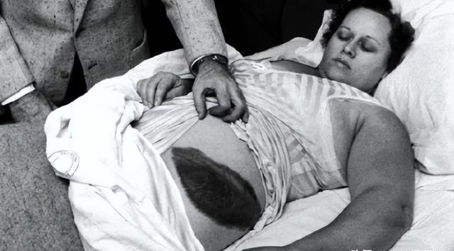 1954年3月30日，国外一女子正在睡觉中，突然感觉腹部和大腿被什么东西蹭着了一