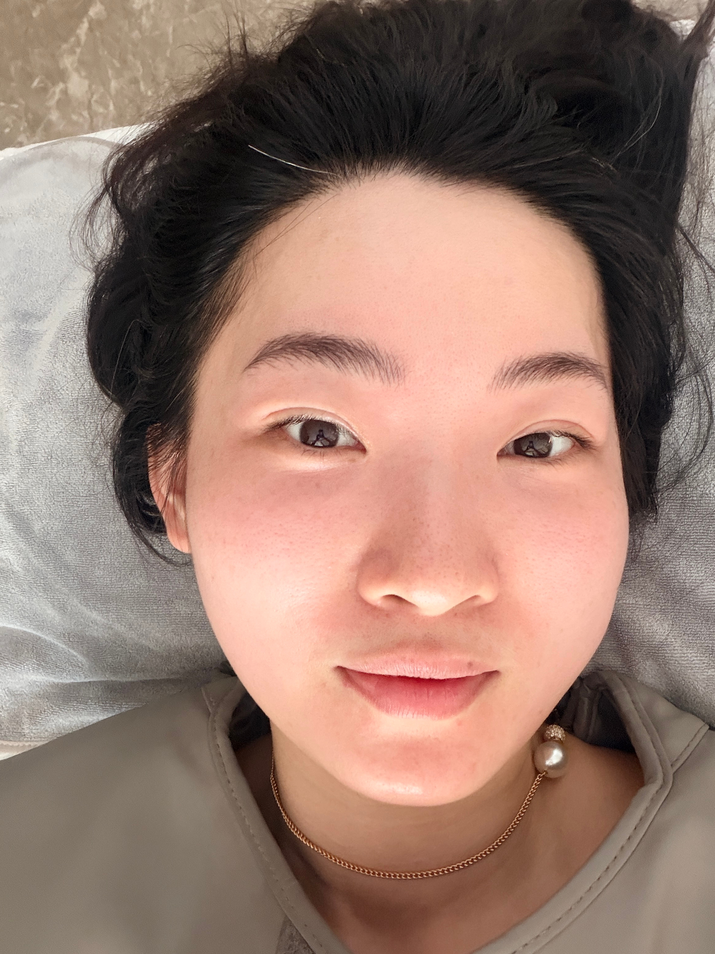 暴汗三天！！身体 脸上 都是白白透透的！ 