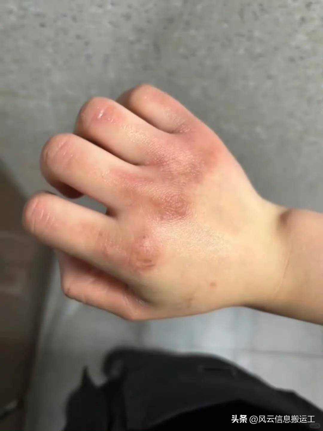 香港餐厅工作真不是轻松的

香港的餐饮业，已经有超过4万内地外劳，然而，待遇比内