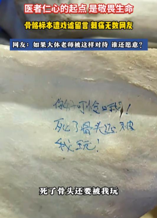 骨骼标本上那几行字，是用蓝墨水写上去的，歪歪扭扭。写的是“死了骨头还要被我玩”。