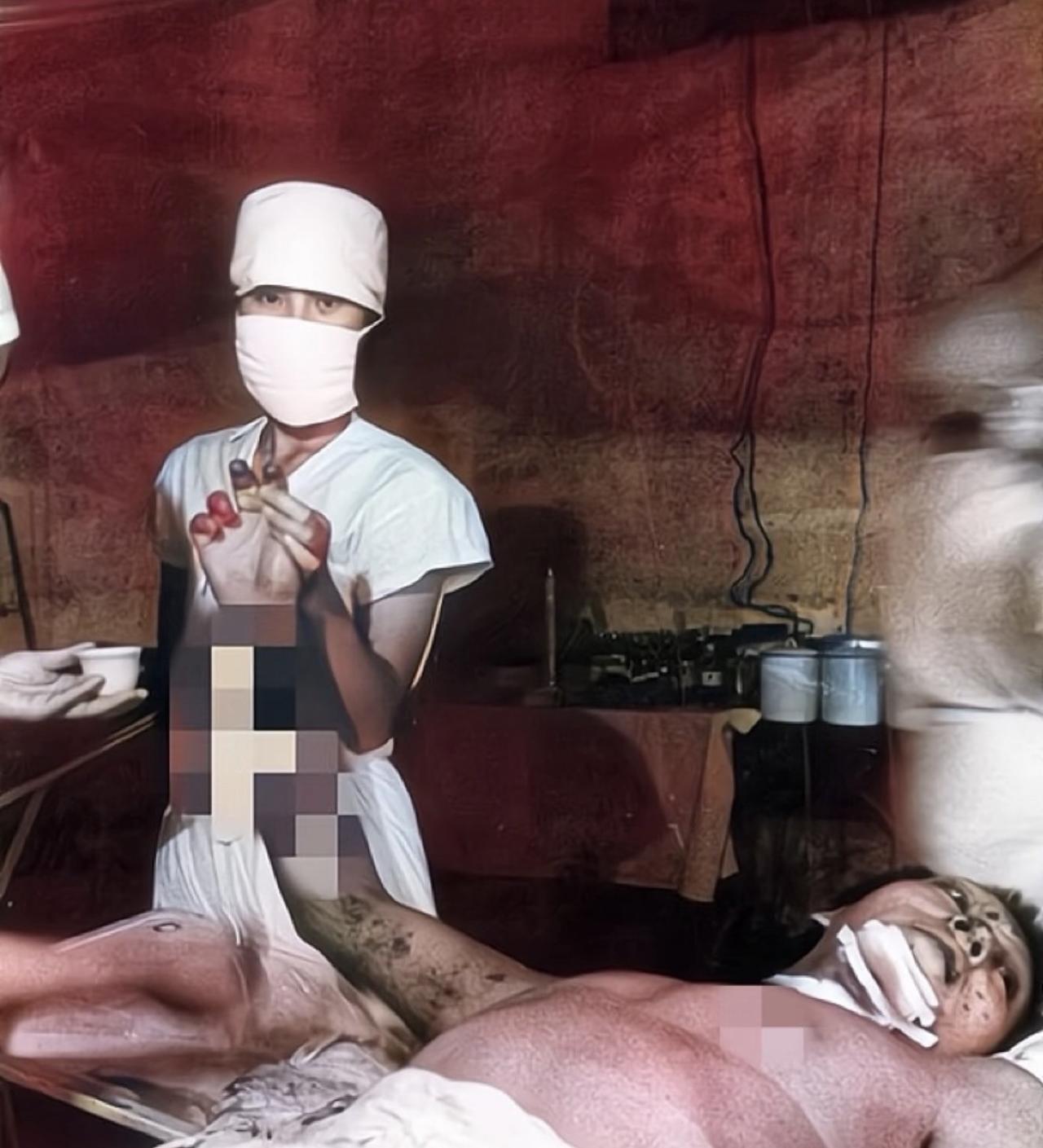 齐常富躺在帐篷里，右臂没了，脸上插着弹片，却睁着眼点头同意拍照。
1986年5月