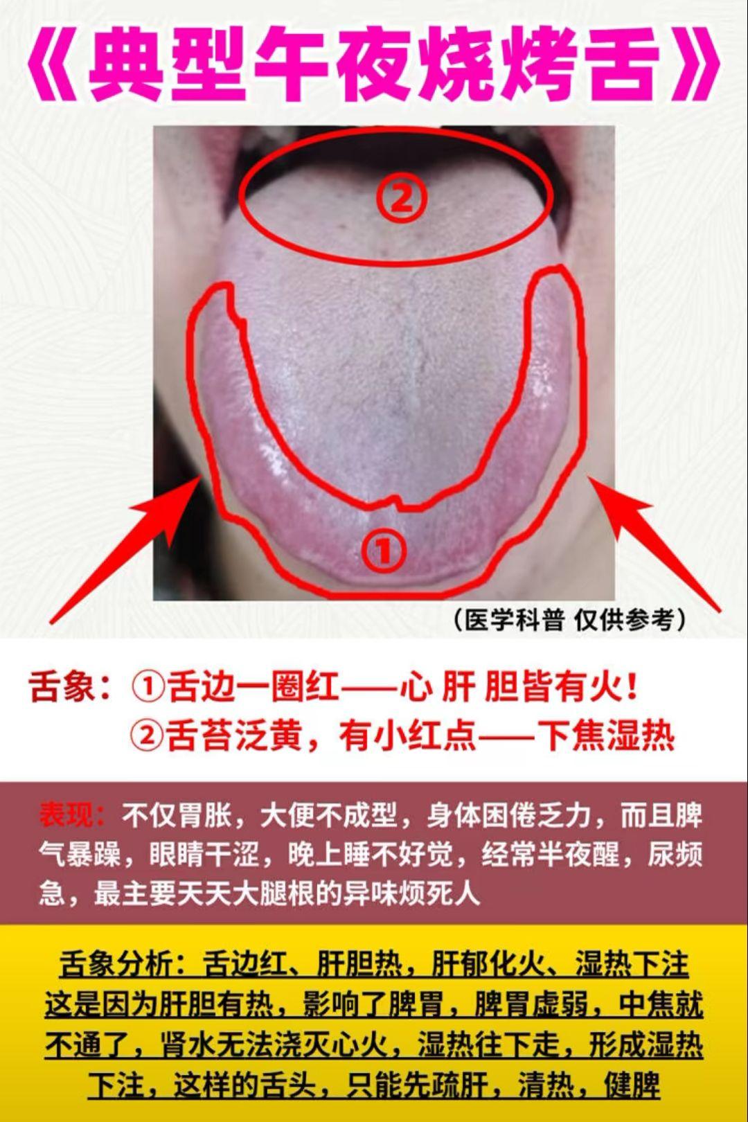 典型午夜烧烤舌 广大朋友看看你的吧