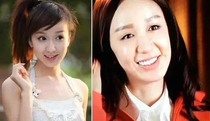 娄艺潇的脸真的可惜了
以前真的好有灵气啊，古灵精怪的样子，演技也好
现在嘛，一会