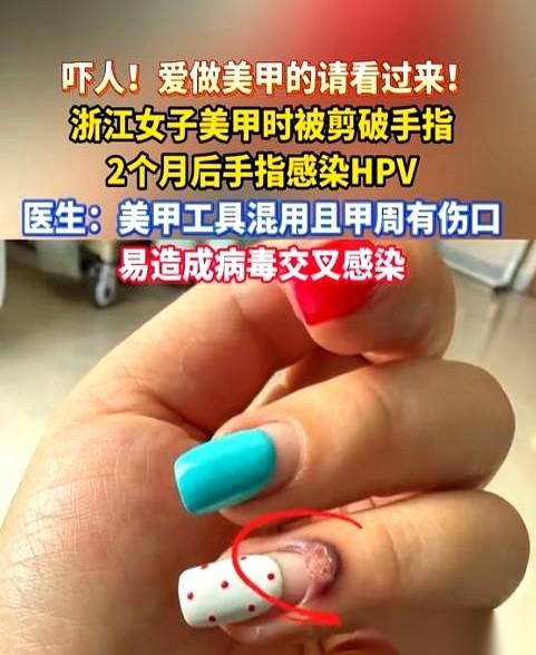 杭州一个姑娘，在美甲店剪死皮，剪子轻轻划了一下。
一个几乎看不见的小口子。她和美