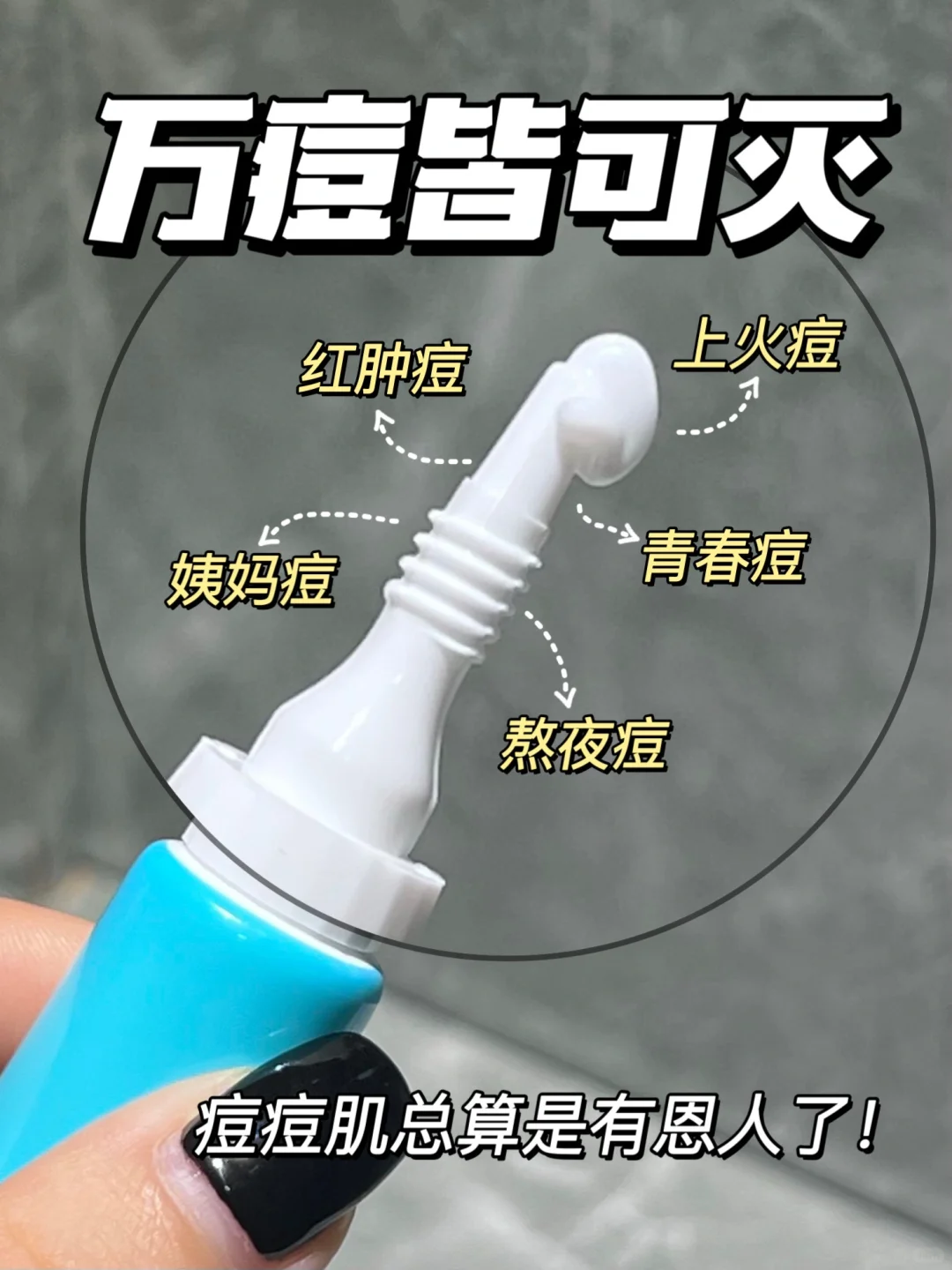 痘痘消消乐❌水煮蛋皮肤也太快乐了