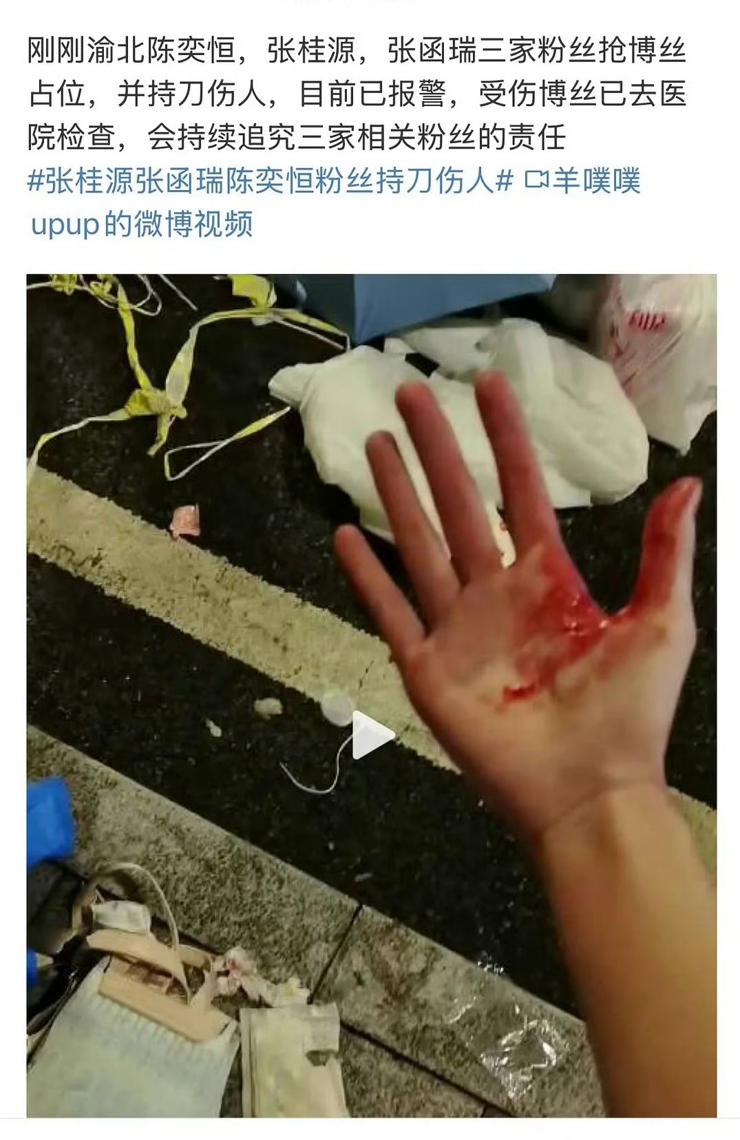 为了追星粉丝都敢持刀伤人了……[衰] ​​​