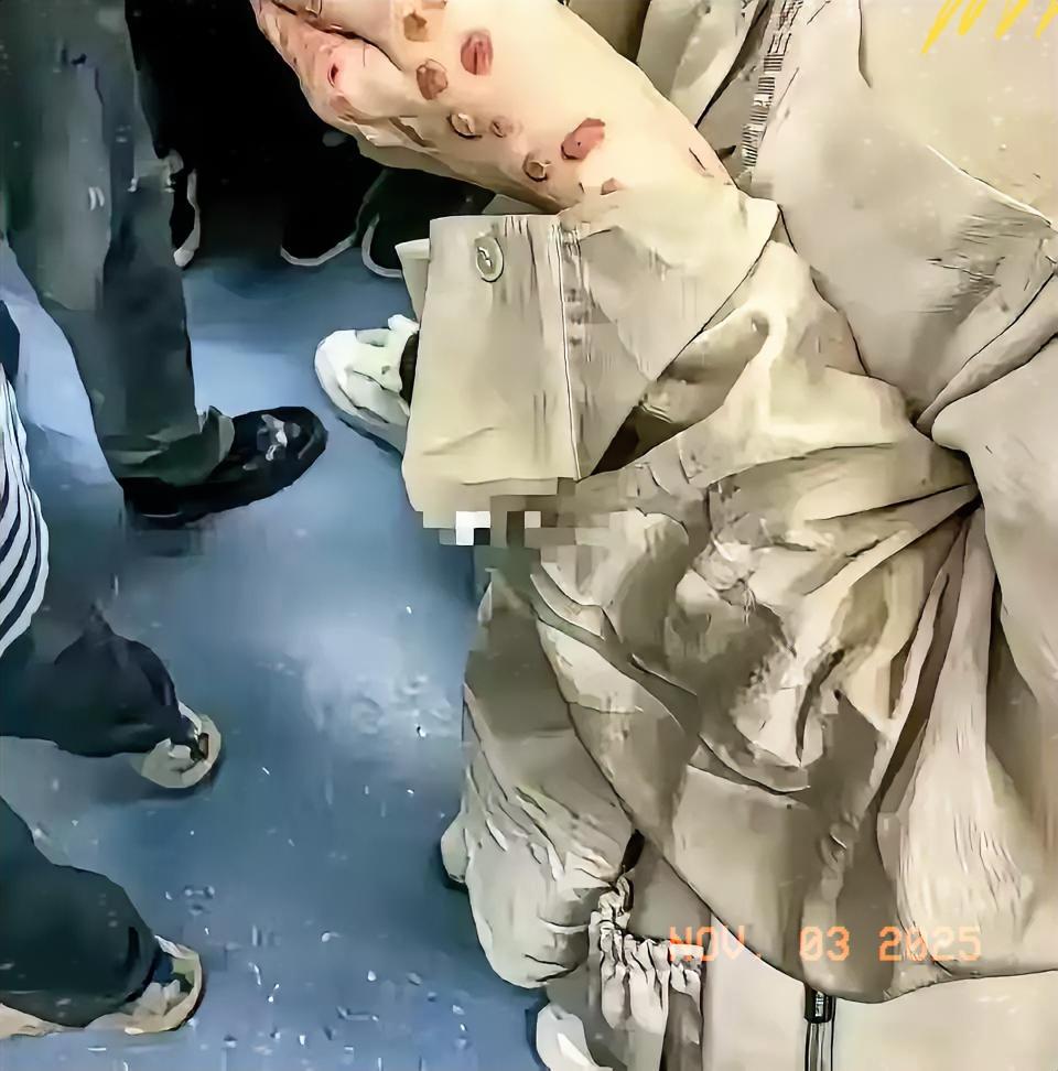 地铁偶遇手有异样的姑娘，我瞬间慌了！这真的会传染吗？
 
早上在地铁里碰到个颜值