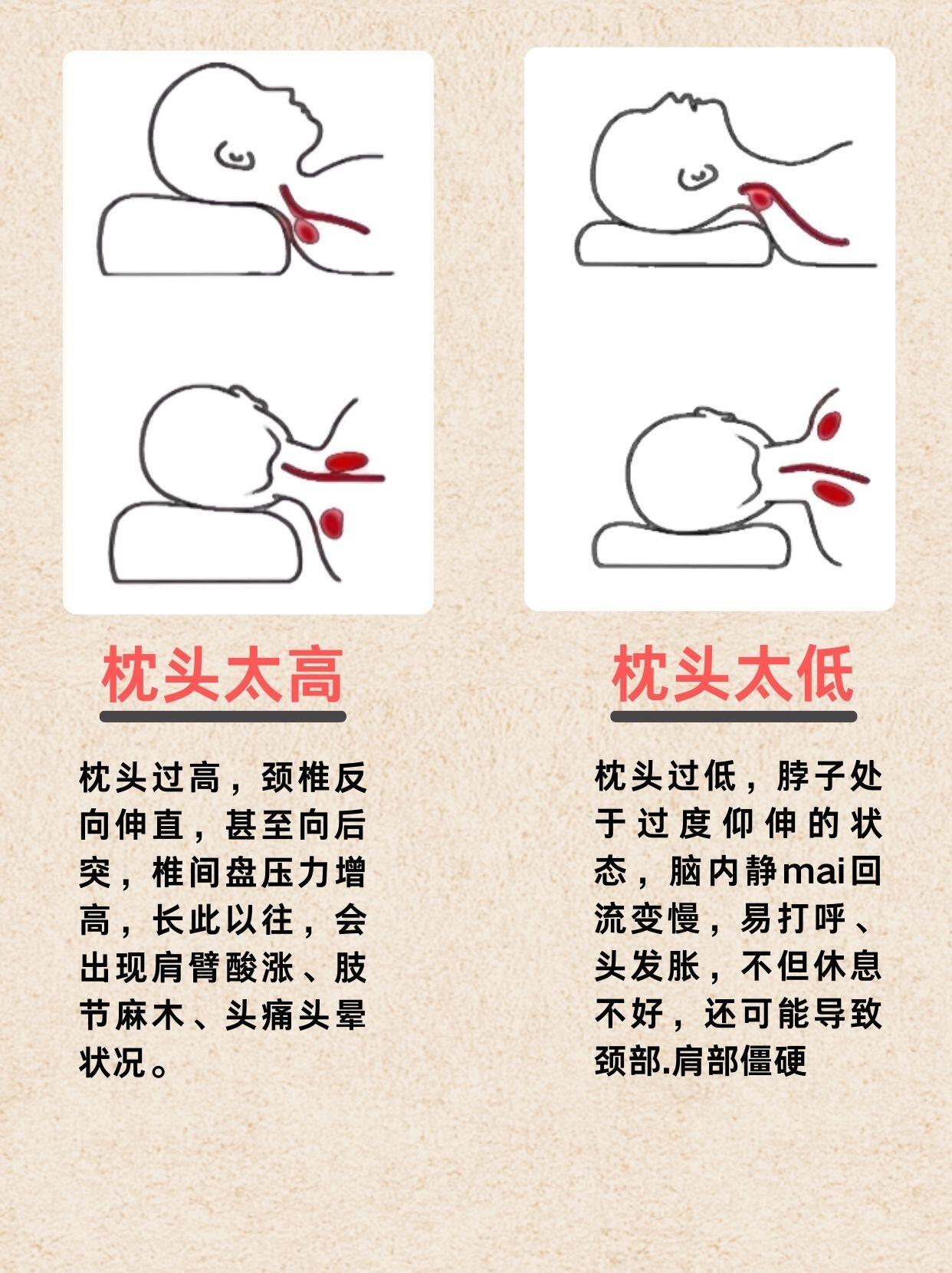 用这种枕头可能损伤脑血管 枕头高度是影响睡眠质量和颈椎健康重要因素，过高或过低都