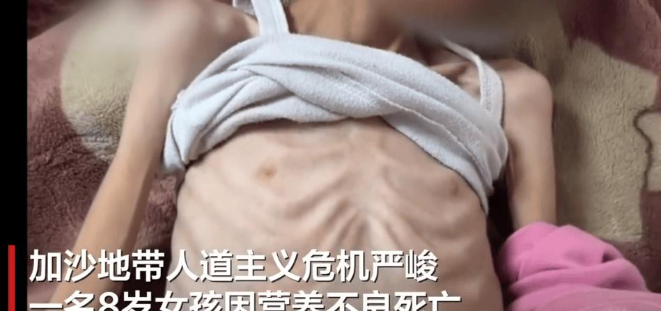 加沙一 8 岁女孩因营养不良死亡，新一轮巴以冲突已致超 1.5 万名儿童死亡，如