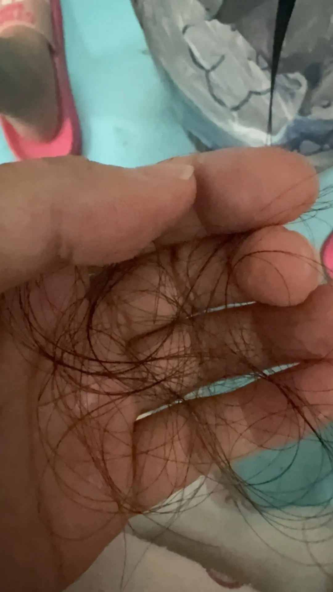 头发都要掉秃了……咋个整哟