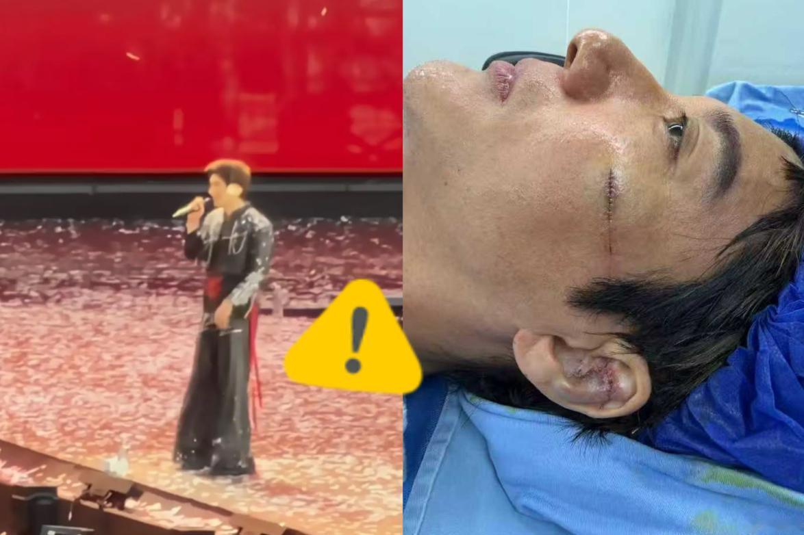 王力宏这一摔，反而因祸得福了？
说实话，换别人可能真就凉了。舞台事故、受伤停工、