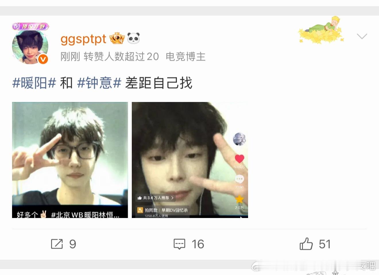 我他妈快笑哭了 效益都自嬷成忧郁小奶t了也改变不了这一脸老鼠像 有这样躺十次手术