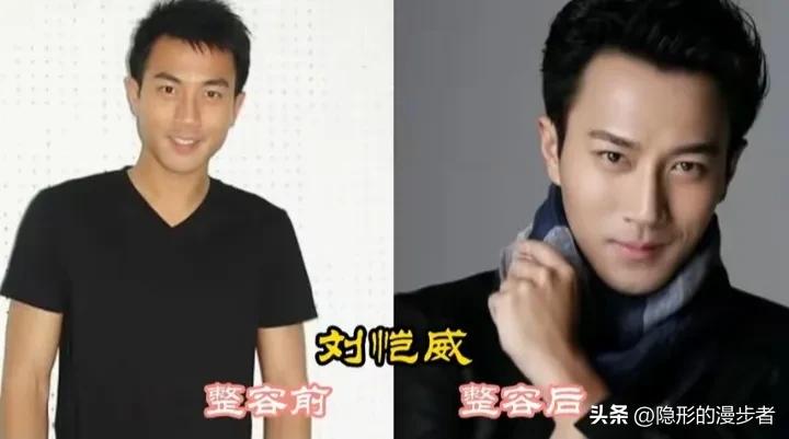 娱乐圈里不少明星都动过脸，效果却是天差地别。华晨宇整完后气质大变，从青涩少年变成