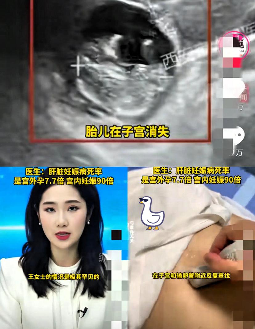 40岁女子停经50天，
抽血查出怀孕满心欢喜，
可B超检查却让所有人倒吸一口凉气
